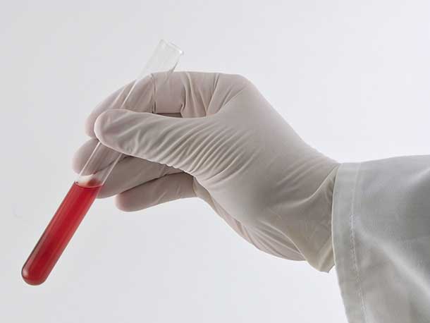 Blood-Sample-Used-in-Hormone-Testing