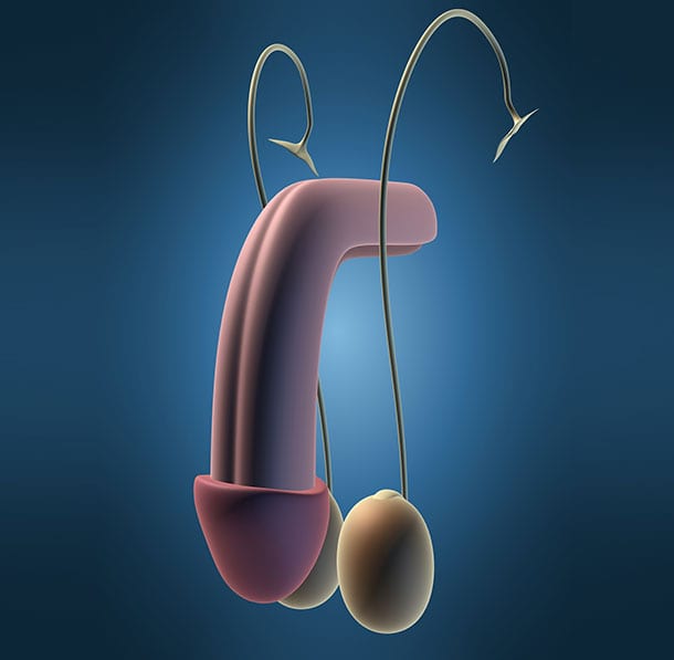 Microscopic-Denervation-of-the-Spermatic-Cord-UCI-Men's-Health