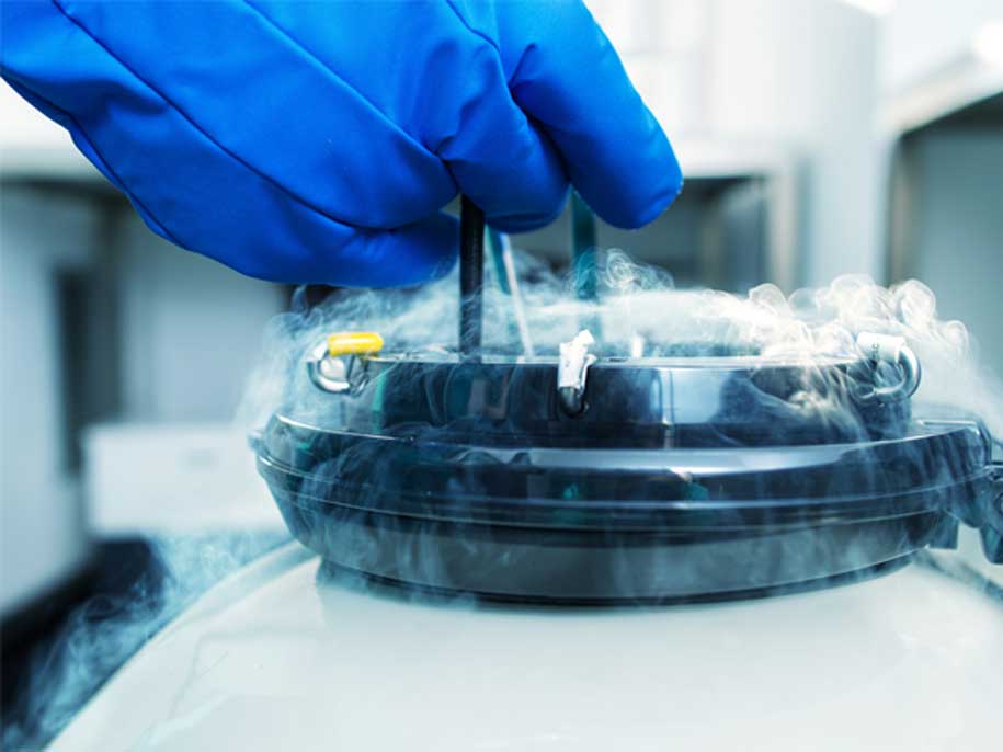 Male-Infertility-UCI-Mens-Health-2 Male-Infertility-UCI-Mens-Health-2
